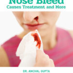 Nose Bleed - Causes Treatment and More