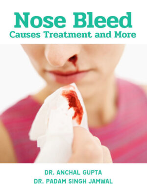 Nose Bleed - Causes Treatment and More