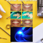 Dental Composites