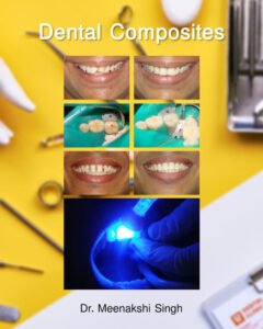 Dental Composites