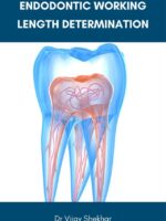 Endodontic Working Length Determination