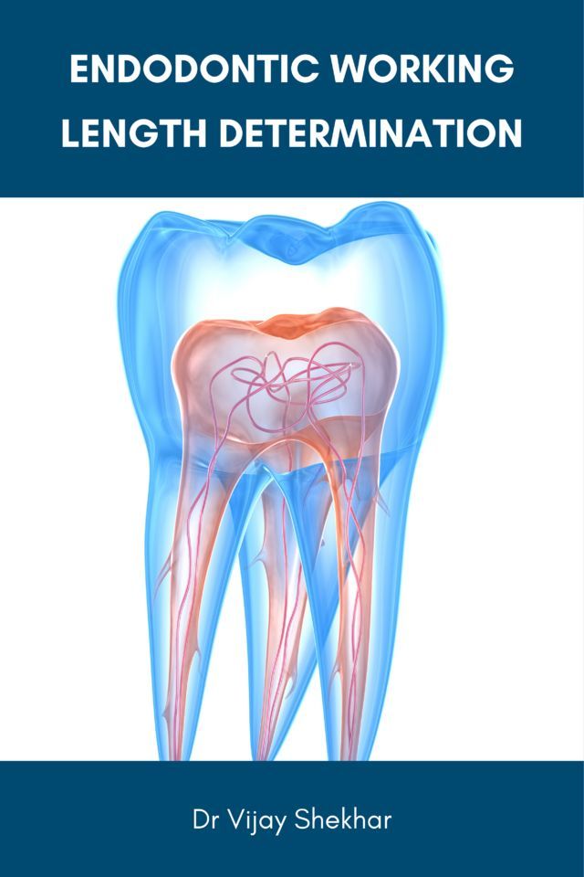 Endodontic Working Length Determination