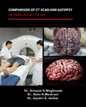 Comparison of CT scan and Autopsy in Head Injury cases