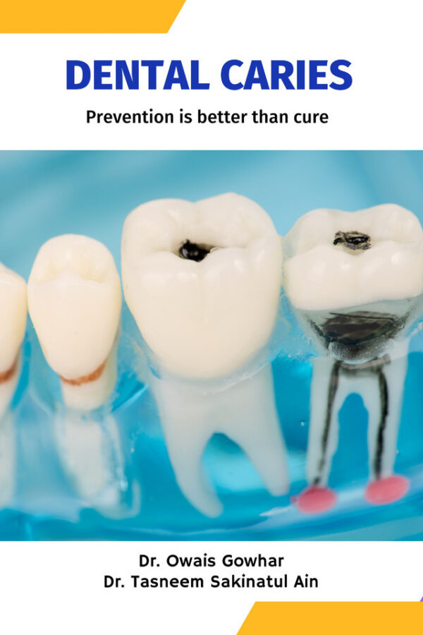 Dental Caries - Prevention is better than cure