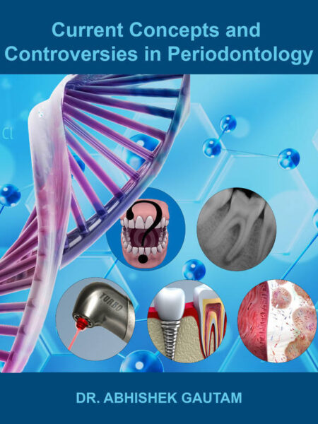 Current Concepts and Controversies in Periodontology