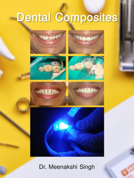 Dental Composites