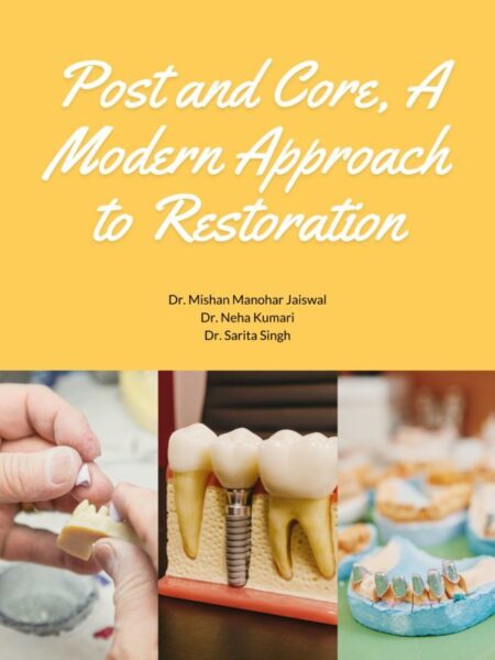 Post and Core, A Modern Approach to Restoration