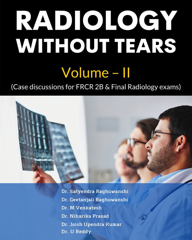 Radiology without tears Volume - II