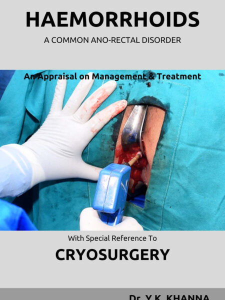 Haemorrhoids