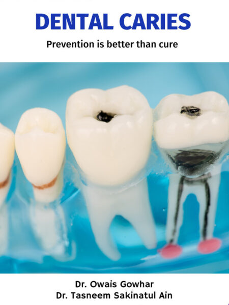 Dental Caries - Prevention is better than cure