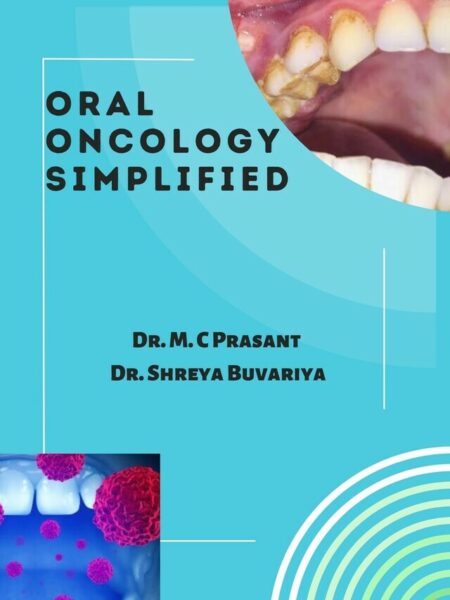 Oral Oncology Simplified