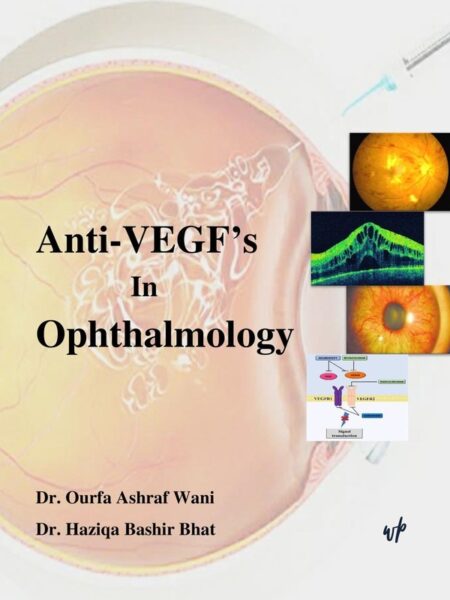 Anti-VEGF’s In Ophthalmology
