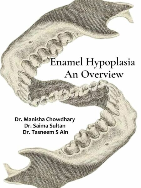 Enamel Hypoplasia: An Overview
